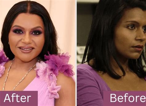 mindy kaling plastic surgery|Mindy Kaling Plastic Surgery: The Truth Behind All Speculations